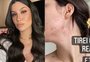 Bianca Andrade mostra pele sem filtro e com acne após parto: "Realidade da mamãe aqui"