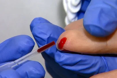 Carazinho recebe mil testes rápidos para enfrentar surto de febre chikungunya<!-- NICAID(16036587) -->