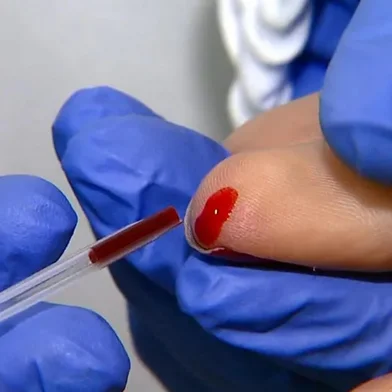 Carazinho recebe mil testes rápidos para enfrentar surto de febre chikungunya<!-- NICAID(16036587) -->