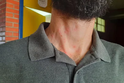 EEEF Maria José Mabilde tem aulas suspensas após reações alérgicas por cerdas de mariposa - Foto: Laura Becker/Agência RBS<!-- NICAID(15381491) -->