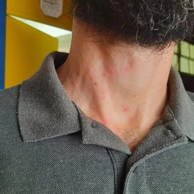 EEEF Maria José Mabilde tem aulas suspensas após reações alérgicas por cerdas de mariposa - Foto: Laura Becker/Agência RBS<!-- NICAID(15381491) -->