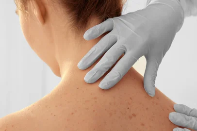 Africa Studio / Adobe Stock Dermatologist examining patient in clinic, closeup<!-- NICAID(16265404) -->