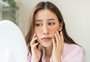 Manchinhas no rosto? Confira cuidados com o melasma no verão