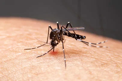 Striped mosquitoes are eating blood on human skin. Mosquitoes are carriers of dengue fever and malaria.Dengue fever is very widespread during the rainy season.Fonte: 306185088Fotógrafo: Striped mosquitoes are eating bl<!-- NICAID(15670890) -->