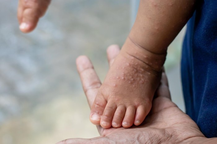 Chamli_Pr / stock.adobe.com Chamli_Pr / stock.adobe.com