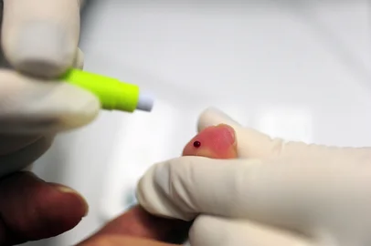 CAXIAS DO SUL, RS, BRASIL, 29/11/2018. Testagem rápida é um dos caminhos mais práticos para saber se está infectado pelo HIV. Serviço é oferecido no Centro Especializado de Saúde (CES).(Porthus Junior/Agência RBS)Indexador: Porthus Junior                  <!-- NICAID(13853972) -->