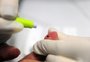 Casos de HIV entre idosos quase triplicaram em Passo Fundo na última década