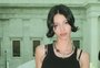 O que é a malformação arteriovenosa, doença rara que levou modelo de 27 anos à morte