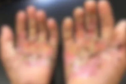 Mãe é presa suspeita de tortura após filho relatar ter sido queimado no fogão e ter sal jogado nas feridas como castigo, diz polícia<!-- NICAID(16138134) -->