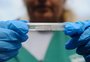 Vacina contra dengue volta a ser oferecida na rede privada de Porto Alegre; veja valores, onde fazer e quem pode tomar