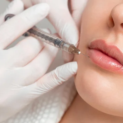 A woman makes lip shape correction in a cosmetology clinic. Lips injections, lip augmentation.A woman makes lip shape correction in a cosmetology clinic. Lips injections, lip augmentation. Foto: Aleksandr Rybalko / stock.adobe.comFonte: 527945312<!-- NICAID(15865708) -->