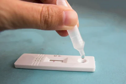 Rapid antigen test kit :  Covid autotest bought at pharmacy, to Fonte: 473766328<!-- NICAID(15025063) -->