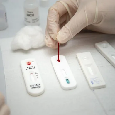 Teste de HIV em Caxias do Sul. <!-- NICAID(14773769) -->