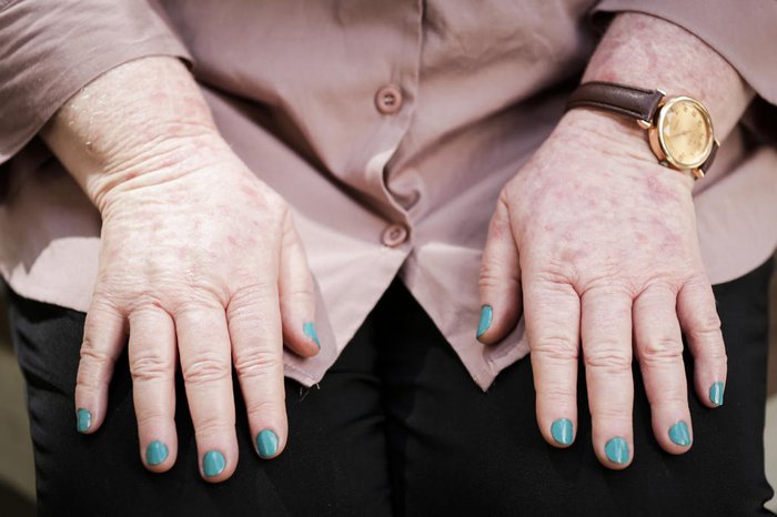 Mateus Bruxel / Agencia RBS