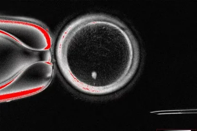Pela primeira vez, cientistas transformam células da pele em óvulos fecundáveis<!-- NICAID(16136522) -->