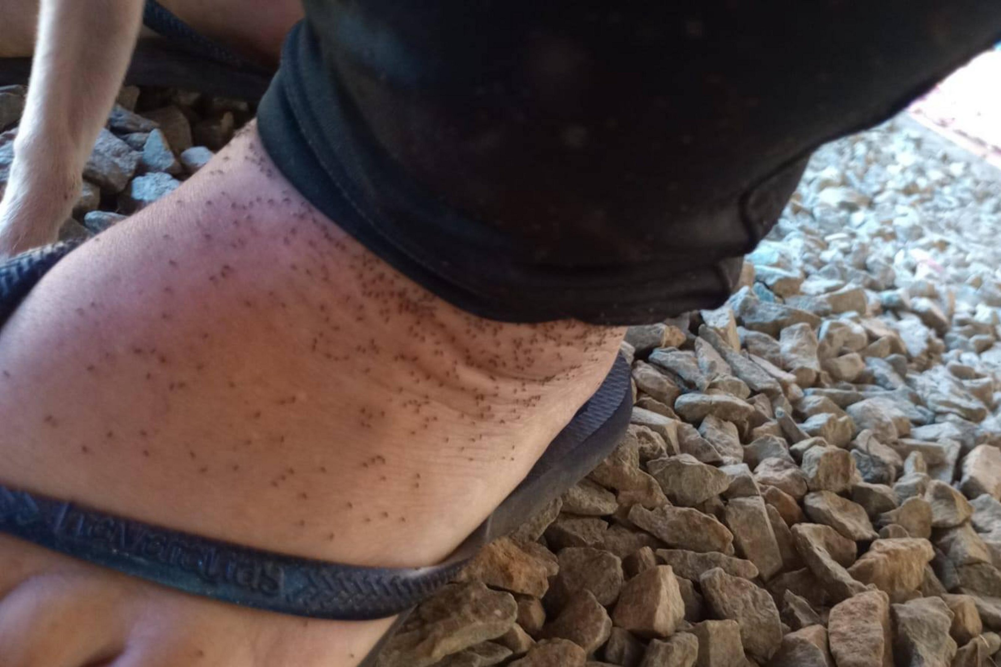 O que &eacute; o maruim? Surto do inseto que transmite doen&ccedil;a sem vacina preocupa moradores em cidade de SC