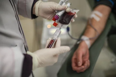 PORTO ALEGRE, RS, BRASIL - 2024.08.17: Doação de sangue no HCPA. (Foto: Renan  Mattos/ Agência RBS)<!-- NICAID(15843240) -->