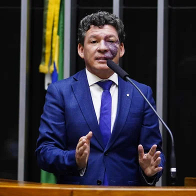 Reginaldo Lopes<!-- NICAID(15355427) -->