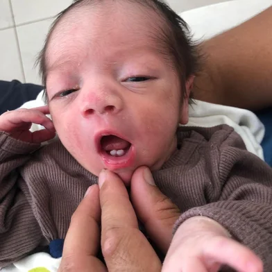 Bebê chama a atenção ao nascer com dois dentes em Novo Hamburgo - Foto: Dioni Wathier/Arquivo Pessoal<!-- NICAID(15376220) -->