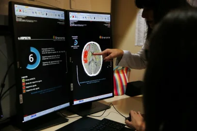 PORTO ALEGRE, RS, BRASIL, 12-01-2019: Para aumentar as chances de pacientes com sintomas de AVC a receberem tratamento de urgência, o Hospital Moinhos de Vento foi o primeiro da América Latina a adquirir um software com soluções integradas para automatização da avaliação da circulação cerebral, angiotomografia e tomografia. Utilizando inteligência artificial, o e-STROKE Suite permite avaliar os casos com maior profundidade. A médica Sheila Martins apresentou o programa para a reportagem (FOTO FÉLIX ZUCCO/AGÊNCIA RBS, Editoria SuaVida).<!-- NICAID(13912505) -->