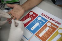 PORTO ALEGRE, RS, BRASIL - 2023.12.01 - Mortes por aids crescem 5% em Porto Alegre; taxa é quase seis vezes maior do que a do Brasil. Mortalidade na Capital também é quase três vezes maior do que a do Estado (Foto: André Ávila/ Agência RBS)Indexador: Andre Avila<!-- NICAID(15614591) -->