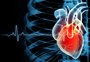 Como perceber a fibrilação atrial, arritmia crônica mais comum no mundo