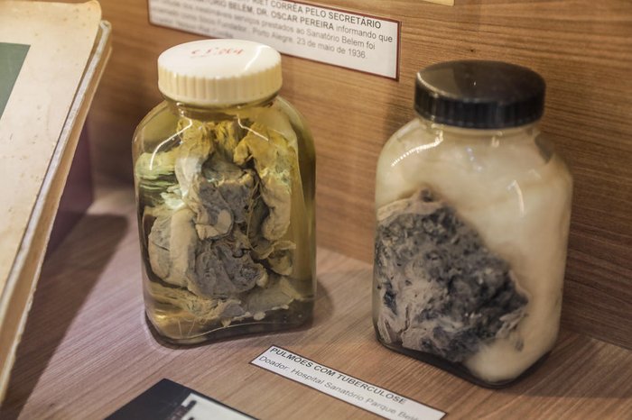 Marco Favero / Agencia RBS