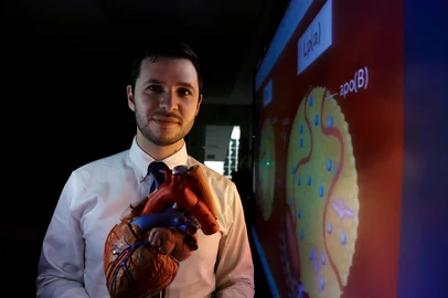 Porto Alegre, RS, Brasil – O cardiologista André Zimerman, do Hospital Moinhos de Vento e professor da UFRGS, explica a importância da dosagem da lipoproteína(a), exame agora recomendado ao menos uma vez na vida segundo a nova Diretriz de Dislipidemias e Prevenção da Aterosclerose da Sociedade Brasileira de Cardiologia. Foto: Jeff Botega/Agência RBSIndexador: jeff botega<!-- NICAID(16145308) -->