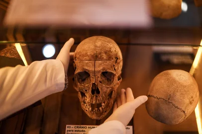 PORTO ALEGRE, RS, BRASIL, 13-06-2024: Reconstrução facial forense a partir do crânio de um individuo com microcefalia. Item da coleção do Museu da História da Medicina do Rio Grande do Sul, crânio de indivíduo francês, nomeado pelos pesquisadores de Darcy, do início do século XX com microcefalia, tem seu rosto reconstituido digitalmente com técnicas de reconstituição forense. Foto: Jonathan Heckler/Agência RBS.<!-- NICAID(16059027) -->