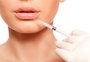 Quanto tempo dura? O resultado é imediato? Confira perguntas e respostas sobre preenchimento labial