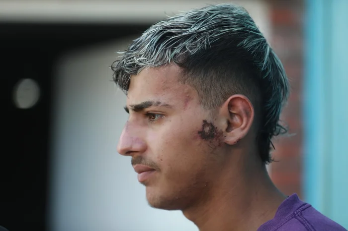 Renan Mattos / Agência RBS