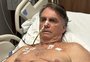 Bolsonaro segue sem movimentos intestinais há duas semanas e permanece na UTI