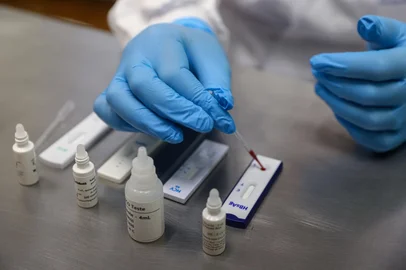 CAXIAS DO SUL, RS, BRASIL, 24/01/2025. Matéria sobre os índices de HIV em Caxias do Sul. Além dos dados, a reportagem também conheceu o que é oferecido para o diagnóstico e tratamento na rede pública de saúde. (Bruno Todeschini/Agência RBS)Indexador: Bruno Todeschini<!-- NICAID(15960830) -->
