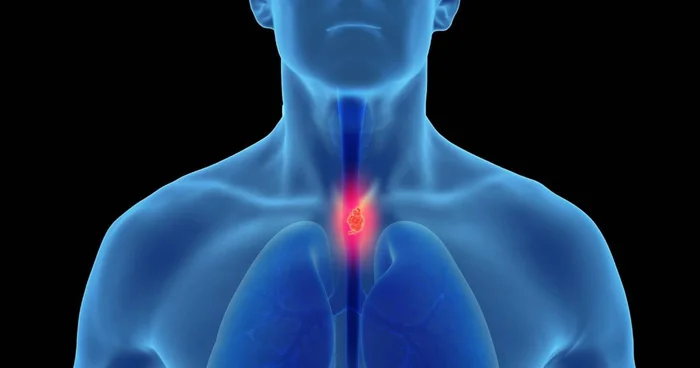 Reprodução / oncoguia.org Reprodução / oncoguia.org
