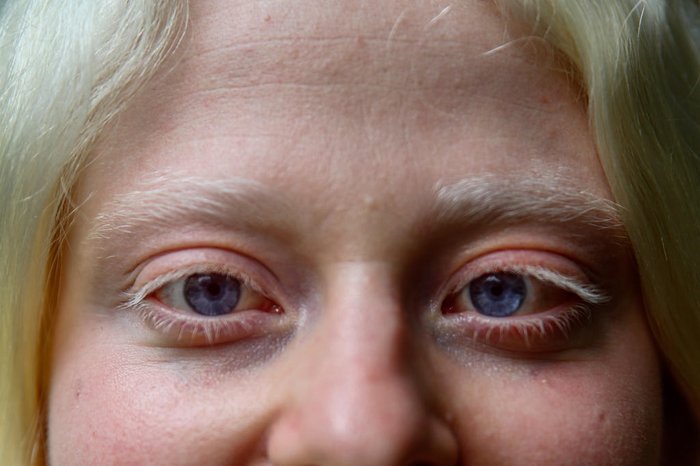 Jonathan Heckler / Agencia RBS