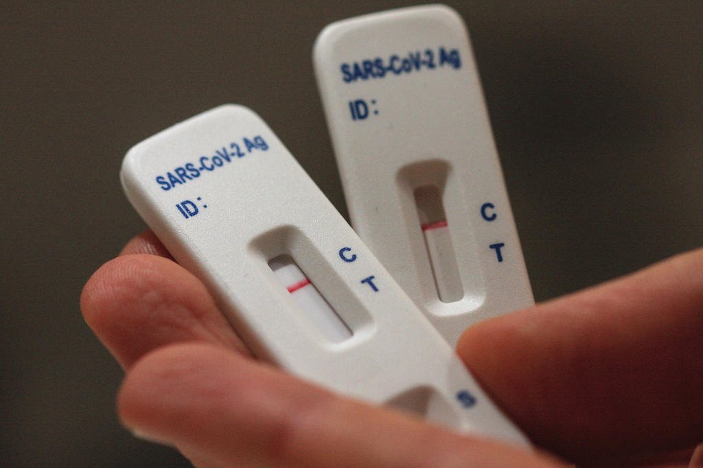 RS tem alta de 54% nos casos de covid-19 em duas semanas, mas segue distante de picos anteriores