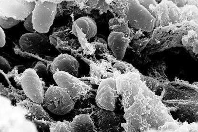 Yersinia pestis<!-- NICAID(16381286) -->
