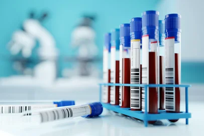 A row of human blood samples in a medical laboratory ready to be tested. healthcare background 3D illustration.<!-- NICAID(15724833) -->