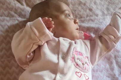 Laís é o bebê com menor peso nascida no hospital de Clínicas de Porto Alegre com 465 gramas. Foto: Patricia Bianquim / Arquivo Pessoal<!-- NICAID(15998625) -->
