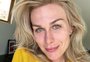 Atriz de "Malhação" e "Senhora do Destino", Ludmila Dayer revela diagnóstico de esclerose múltipla: "Meu mundo caiu"