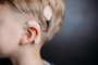cochlear implant on the boyâs head. hearing aid. copy spaceIndexador: Aleksandr RumiantsevFonte: 330141808<!-- NICAID(15199327) -->