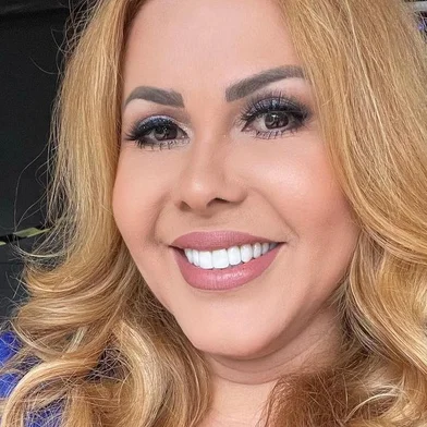 Joelma recebe alta após internação por edema no rosto<!-- NICAID(15121784) -->