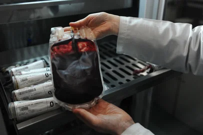 CAXIAS DO SUL, RS, BRASIL, 15/06/2023. A reportagem foi até o Hemocentro de Caxias do Sul acompanhar os processos pelos quais o sangue passa desde o momento da doação até estar pronto para a pessoa que precisa receber. (Bruno Todeschini/Agência RBS)Indexador: BTK<!-- NICAID(15457311) -->