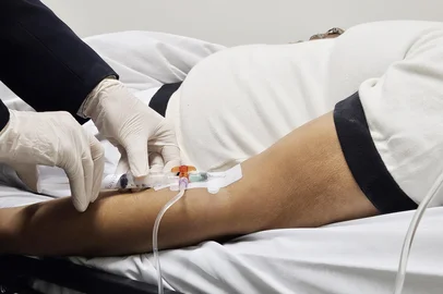 Santa Casa aplica terapia radioligante para câncer de próstata no Rio Grande do Sul<!-- NICAID(15939071) -->