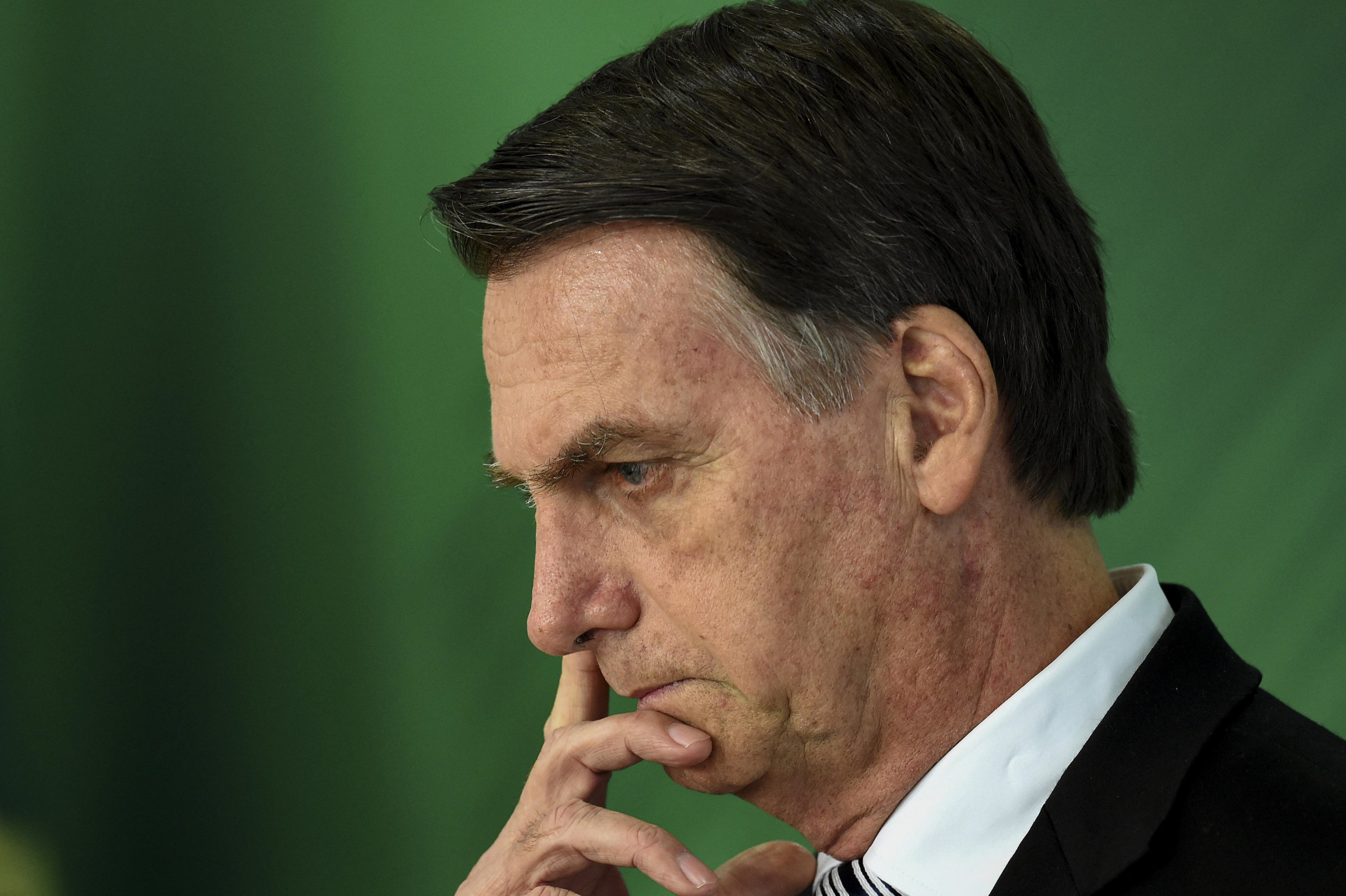 Bolsonaro &eacute; transferido da sede da PF para interna&ccedil;&atilde;o em hospital; ex-presidente ir&aacute; passar por cirurgia na quinta-feira