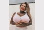 Caxiense Sabrina Boing Boing colocou seis litros de silicone nos seios. Faz mal? 