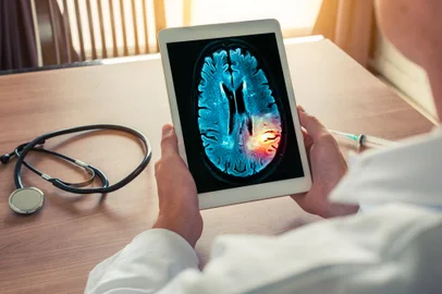 Meningite - Foto: steph photographies/stock.adobe.comFonte: 216842356<!-- NICAID(15499534) -->