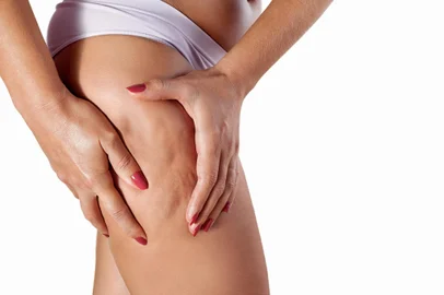 Woman squeezing her thigh with hands to show celluliteIndexador: Photographer: Visnjican DusankaFonte: 176879653<!-- NICAID(15519401) -->