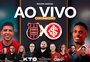 Brasil de Pelotas x Inter ao vivo com imagens na Jornada Digital da Gaúcha; acompanhe  