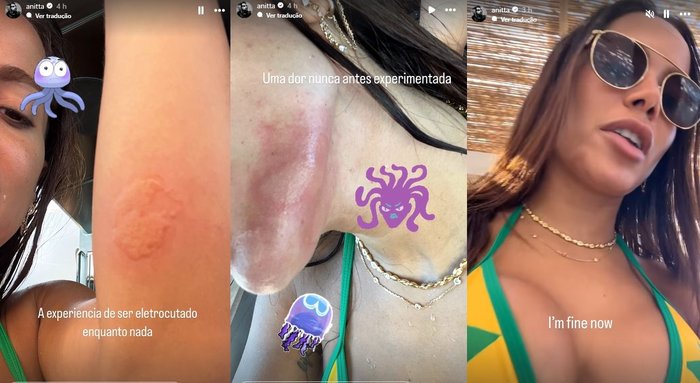 @anitta / Reprodução, Instagram